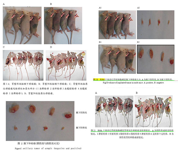 中山醫(yī)院院長博士論文涉抄襲學(xué)生論文:連致謝也抄